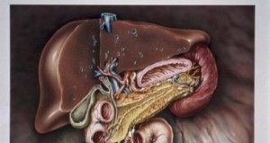 N0020071 Anatomy of liver, pancreas & gall bladder
